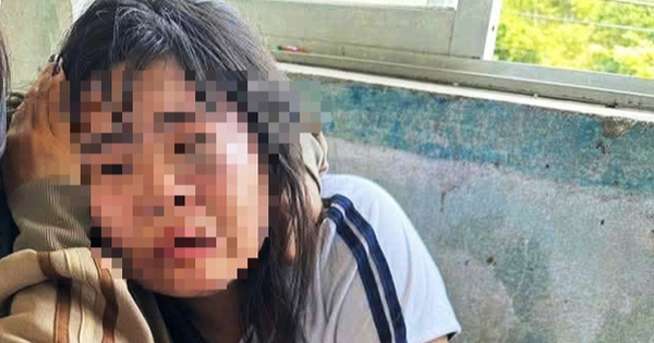 Nữ sinh lớp 7 bị 2 nam sinh lớp 9 đánh nhập viện