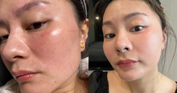 Tôi từng “ném tiền qua cửa sổ” vì mê spa, cho đến khi nhận ra: Chỉ cần 3 phút đắp lotion mỗi ngày, da cũng có thể đẹp lên