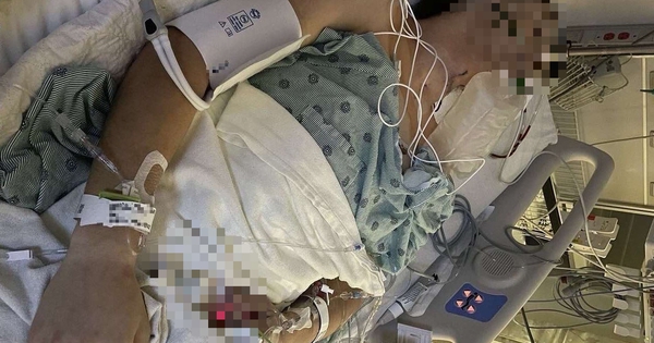 Chàng trai 26 tuổi phải cắt bỏ hơn 10cm 