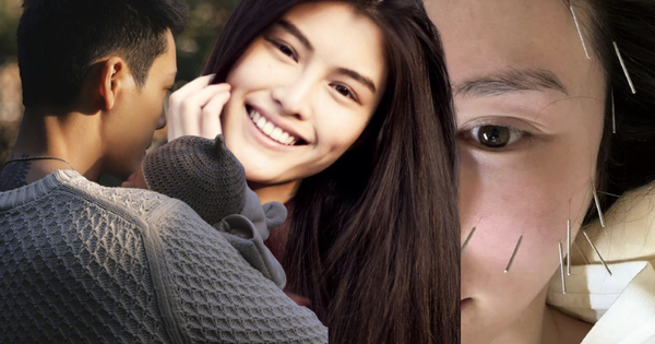 Vợ tổng tài hot nhất Trung Quốc ghim hàng chục cây kim lên mặt để ngăn xệ sau sinh