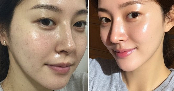 Làm 4 việc trước khi ngủ, làn da 