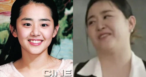 Moon Geun Young bị hoại tử và phát tướng mất kiểm soát do bệnh quái ác, bỏ lỡ giai đoạn vàng để điều trị