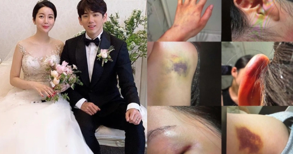 Anh trai Jisoo (BLACKPINK) lại trở thành tâm điểm phẫn nộ: Bị tố bạo hành gia đình, bắt vợ phải quỳ gối xin tha?