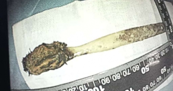 Đau bụng đi khám, người đàn ông 