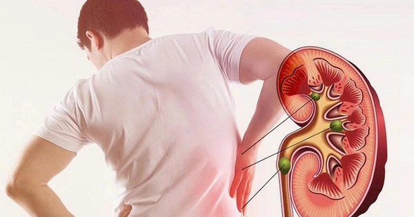 Tỷ lệ suy thận tăng nhanh: Bác sĩ nhắc, hàng ngày thường xuyên làm 4 VIỆC khiến thận 