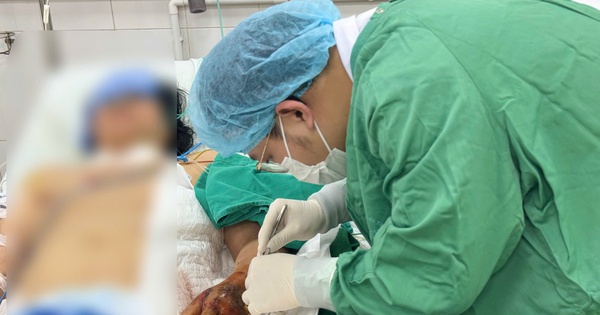 Vi khuẩn 'ăn mòn' bàn tay sau mũi tiêm, người phụ nữ suýt mất mạng