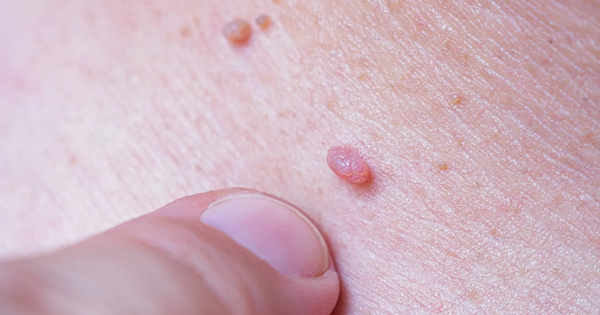 Phụ nữ từng quan hệ tình dục nên biết