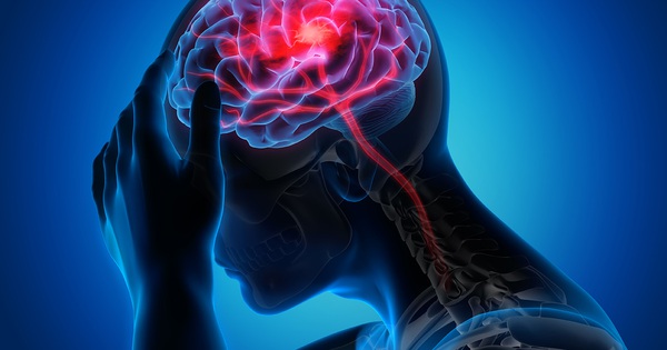 Người dễ bị đột quỵ thường có 10 đặc điểm này: Có 1 cũng cần hành động ngay