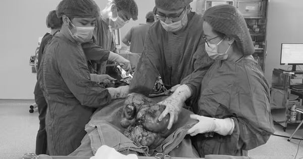 Đau âm ỉ vùng bụng suốt, người phụ nữ sốc khi bác sĩ lấy ra thứ 