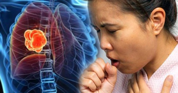 2 dấu hiệu khi ho cảnh báo ung thư phổi dễ bị bỏ qua