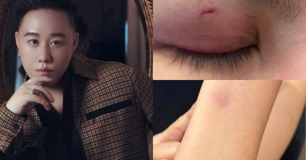 Ca sĩ Trung Quân Idol bị tố hành hung phụ nữ: Luật sư nói gì về trách nhiệm pháp lý?