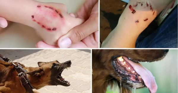 3 người bị chó dại cắn tử vong, TPHCM cảnh báo nóng