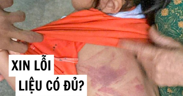 Tôi bàng hoàng khi xem bức ảnh bé gái Tiểu học bị bạn nam cùng lớp đánh bầm lưng: Hỏi thật, một lời xin lỗi liệu có đủ?