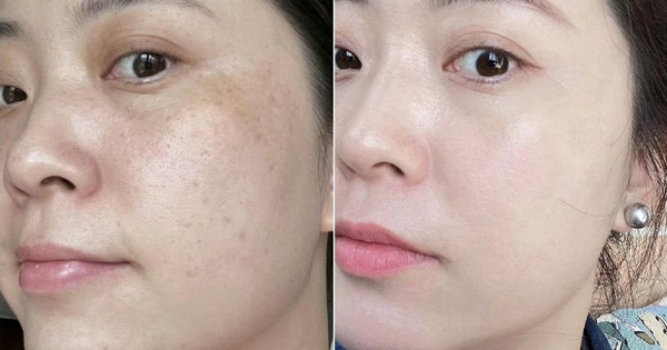 Làm 4 việc này khi thức giấc, làn da tôi “tươi mới” lúc nào không hay