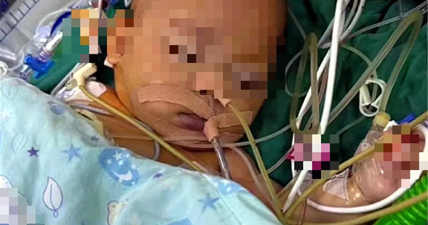 Kỳ lạ em bé 5 tháng tuổi nôn mửa và chán ăn nhưng không khóc tiếng nào, bác sĩ phát hiện sự thật đáng sợ phía sau