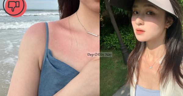 6 lưu ý chống nắng khi đi du lịch để da không bị bỏng rát, tăng sắc tố