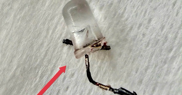 Bác sĩ thót tim gắp đèn LED nằm trong phế quản bé 9 tháng tuổi