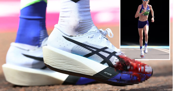 Ám ảnh hình ảnh bàn chân đẫm máu của ngôi sao điền kinh xinh đẹp