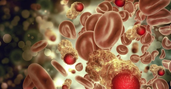 Nghiên cứu 25 năm chỉ ra 2 dấu hiệu nguy hiểm của ung thư máu