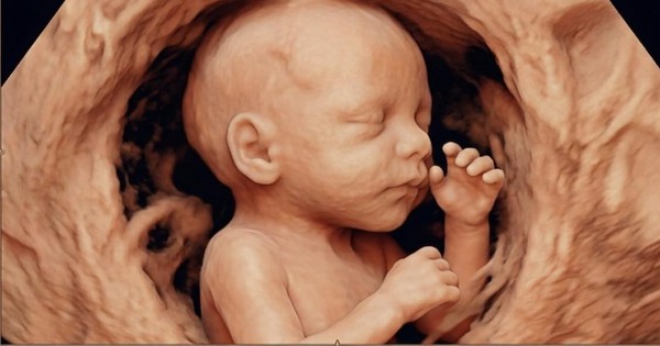 Bác sĩ nghẹn lòng trước mong muốn của sản phụ: 