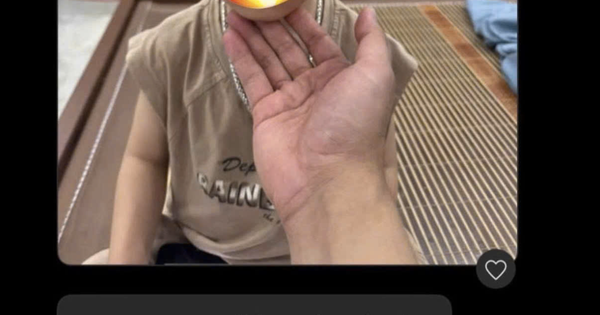 Con đi học về bị ngã sưng tím, phụ huynh nhắn tin 