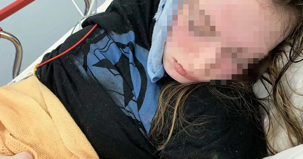 Sự thật về cơn đau đầu do học hành của thiếu nữ 18 tuổi: 