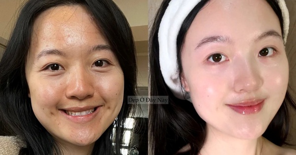 Làm 5 việc này khi đi ngủ, làn da của tôi như 