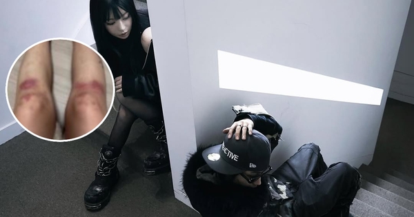 Nữ ca sĩ yêu lại bạn trai cũ từng đánh cô bầm dập toàn thân: “Tôi không kiện anh ấy nữa”