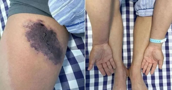 Mặc chiếc quần cũ, người đàn ông suýt "nhiễm độc toàn thân"