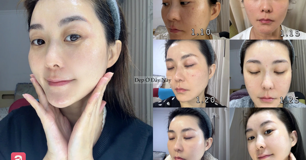 Đi ngủ sớm và bôi thứ này lên da mỗi tối, làn da của tôi sau 1 tháng đã thay đổi hoàn toàn