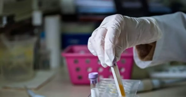 Tưởng rối loạn tiền đình, người phụ nữ mắc viêm màng não do nấm