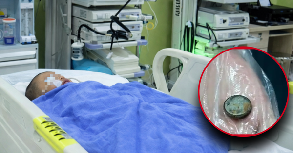 Bé trai 3 tuổi nuốt phải pin cúc áo, mẹ cho uống ngay 1 thìa gia vị, đến bệnh viện bác sĩ khen: 