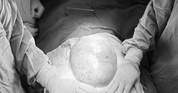 Bé gái 13 tuổi bụng to bất thường, bố mẹ sốc khi phát hiện bí mật 