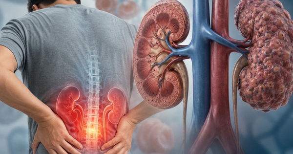 Cảnh báo: Dấu hiệu khi SUY THẬN, chỉ cần nhìn da là có thể phát hiện ngay nhưng nhiều người Việt lại chủ quan bỏ qua!