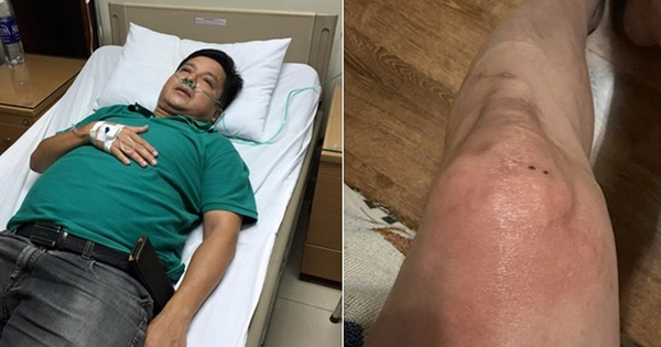 NSƯT Chí Trung mắc bệnh lạ
