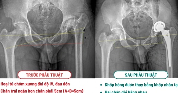 Khách Tây là kỹ sư vượt 10.000km sang 1 bệnh viện ở Việt Nam phẫu thuật: 