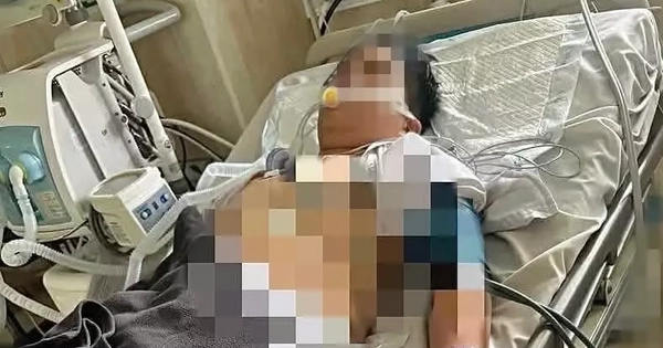 Nam sinh lớp 8 ở Lâm Đồng treo cổ tại nhà nghi bị bạo lực học đường