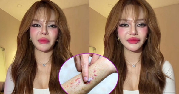 Video lúc nửa đêm của TikToker 11 triệu người theo dõi khiến nhiều người giật mình: Ung thư máu có đến từ thói quen thức khuya, uống trà sữa?