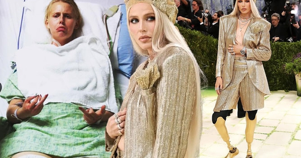 Nữ người mẫu bị cắt cụt chân, 14 năm sau mang chân giả đến đại náo Met Gala