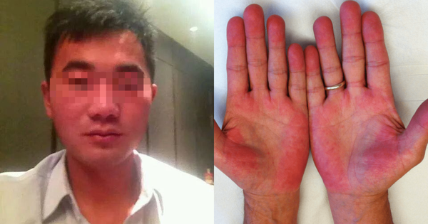 Người đàn ông không bia rượu nhưng ngày nào cũng bị kiểm tra nồng độ cồn, biết sự thật phía sau ai cũng xót xa