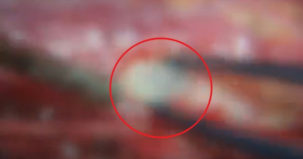 Người phụ nữ đau lưng suốt 2 năm, bác sĩ phát hiện ra bí mật 