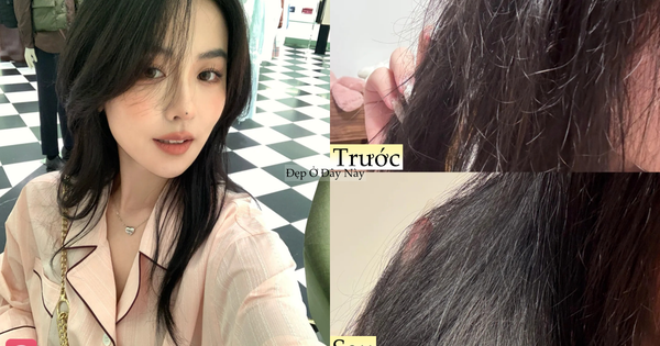 Mái tóc khô xơ, thưa rụng của tôi đã thay đổi bất ngờ nhờ kiên trì với 5 món này