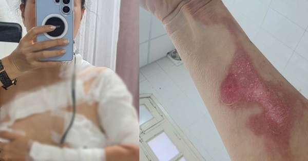 Đi gội đầu dưỡng sinh, cô gái nhận 