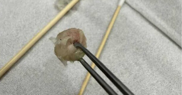 Bé gái 6 tuổi nhập viện khẩn cấp, bố mẹ 