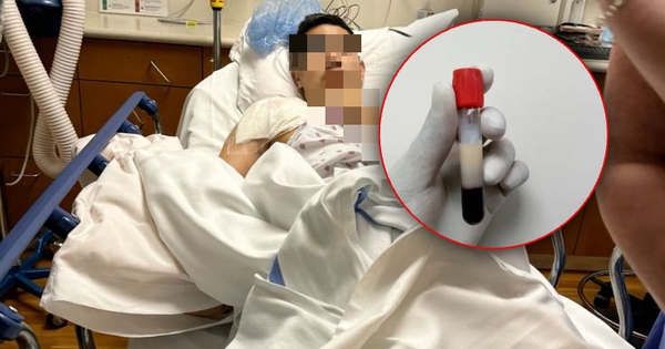 Người đàn ông 28 tuổi máu ngập mỡ, nhớt như dầu: Tất cả tại 2 món khoái khẩu và 2 loại nước 