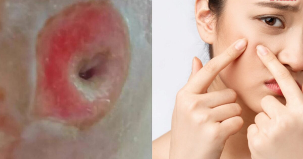 Người phụ nữ 40 tuổi chết lặng khi thấy mặt như 