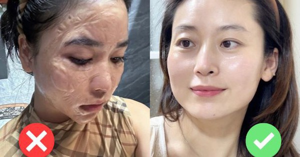 Mua serum làm trắng theo review: Nghe có vẻ đúng, nhưng dễ sai!