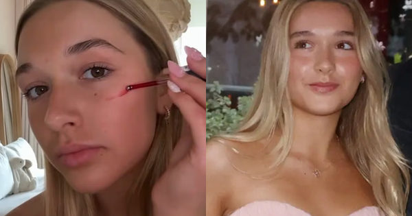 Tiểu thư Harper Beckham dậy thì mặt đầy mụn vì skincare sai cách, làm cả slide thuyết trình xin Victoria... được uốn tóc