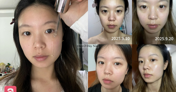 Review 1 tháng dùng serum vitamin C: Làn da có thêm 