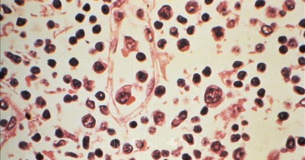 Đài Loan ghi nhận 1 ca tử vong do nhiễm virus Hanta
